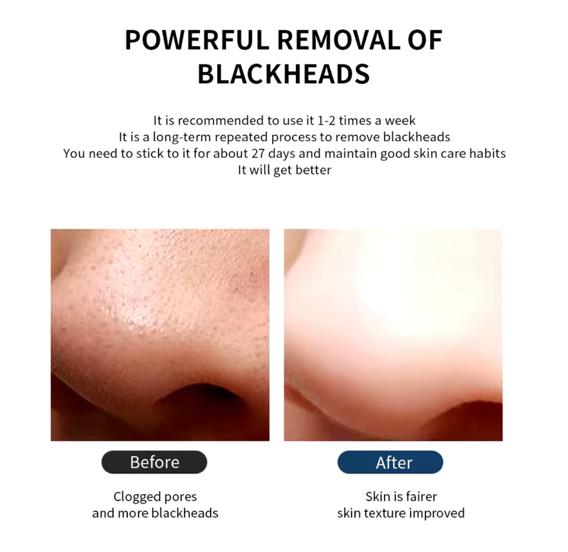 Cell Operated Pore Cleaner, Acne Tool Blackhead Remover, Nose Cleansing Beauty Instrument Cell Operated Pore Cleaner, Acne Tool Blackhead Remover, Nose Cleansing Beauty Instrument
